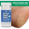 imageHeel Balm for Dry Cracked Feet  Miracle Heel Stick for Cracked Heel Repair  Heel Balm Stick for Cracked Heel Treatment  Formulated with Pure Aloe Vera Tea Tree Oil Shea ampamp Cocoa Butters  25 oz25 Ounce Pack of 1