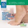 imageHeel Balm for Dry Cracked Feet  Miracle Heel Stick for Cracked Heel Repair  Heel Balm Stick for Cracked Heel Treatment  Formulated with Pure Aloe Vera Tea Tree Oil Shea ampamp Cocoa Butters  25 oz125 Ounce Pack of 2